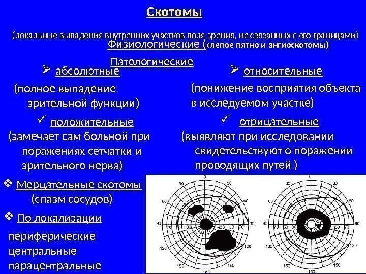  (локальные выпадения внутренних участков поля зрения, не связанных с его границами) абсолютные 