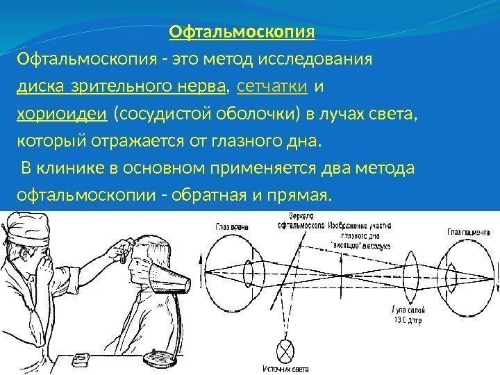  Офтальмоскопия - это метод исследования диска зрительного нерва , сетчатки и хориоидеи (сосудистой