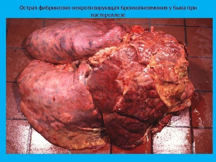 Острая фибринозно-некротизирующая бронхопневмония у быка при пастереллезе 
