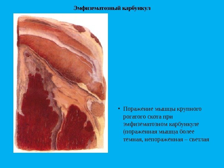 Эмфизематозный карбункул • Поражениемышцыкрупного рогатогоскотапри эмфизематозномкарбункуле (пораженнаямышцаболее темная, непораженная–светлая 