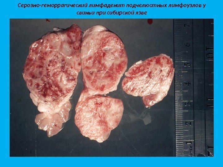 Серозно-геморрагический лимфаденит подчелюстных лимфоузлов у свиньи при сибирской язве 
