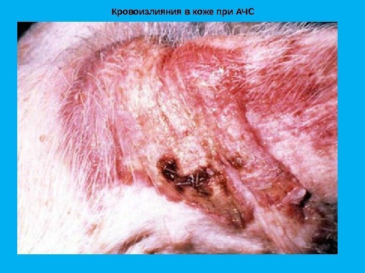 Кровоизлияния в коже при АЧС 