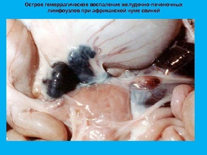 Острое геморрагическое воспаление желудочно-печеночных лимфоузлов при африканской чуме свиней 