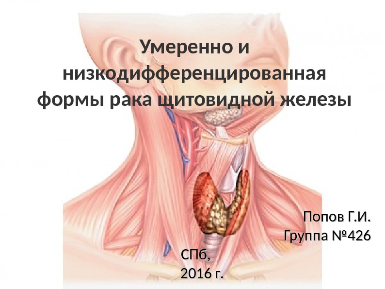 Умеренно и низкодифференцированная формы рака щитовидной железы Попов Г. И. Группа № 426 СПб,