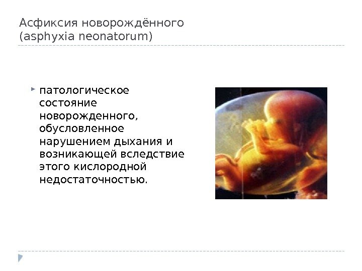 Асфиксия новорождённого (asphyxia neonatorum)  патологическое состояние новорожденного,  обусловленное нарушением дыхания и возникающей