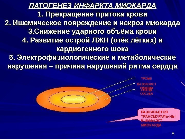 66 СПАЗМ СОСУДАВАЗОКОНСТ РИКЦИЯ ТРОМБ РАЗВИВАЕТСЯ ТРАНСМУРАЛЬ-НЫ Й ИНФАРКТ МИОКАРДАПАТОГЕНЕЗ ИНФАРКТА МИОКАРДА 1. Прекращение