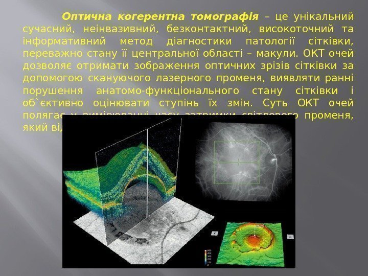    Оптична когерентна томографія  – це унікальний сучасний,  неінвазивний, 