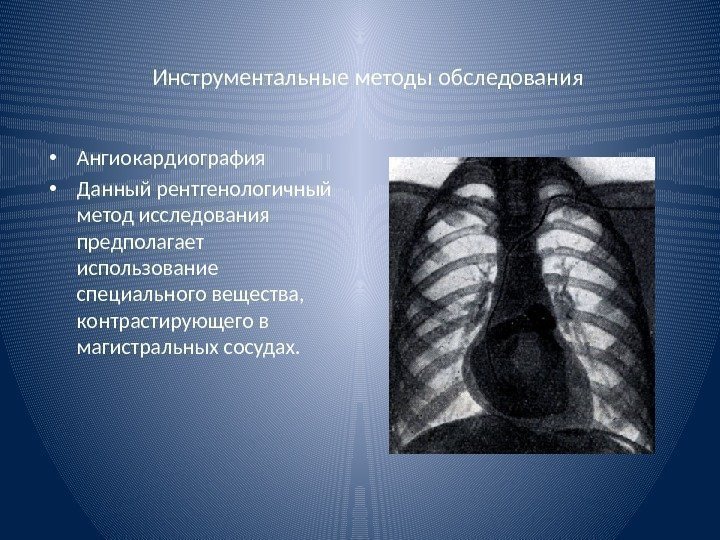 Инструментальные методы обследования • Ангиокардиография • Данный рентгенологичный метод исследования предполагает использование специального вещества,