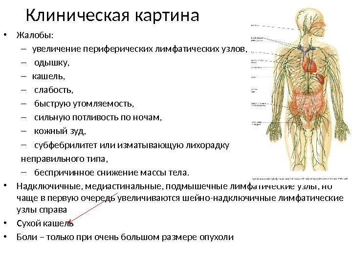 Клиническая картина • Жалобы: – увеличение периферических лимфатических узлов, –  одышку,  –
