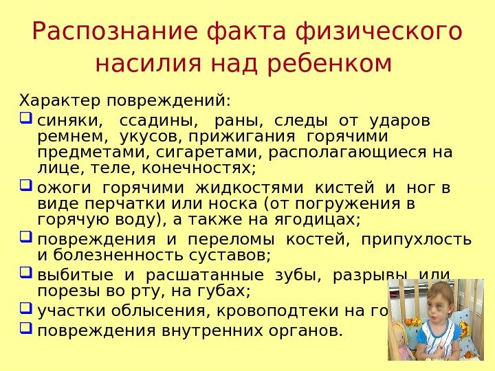 Распознание факта физического насилия над ребенком  Характер повреждений:  синяки,  ссадины, 