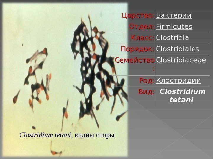 Clostridium tetani ,  видны споры Царство: Бактерии Отдел: Firmicutes  Класс: Clostridia Порядок:
