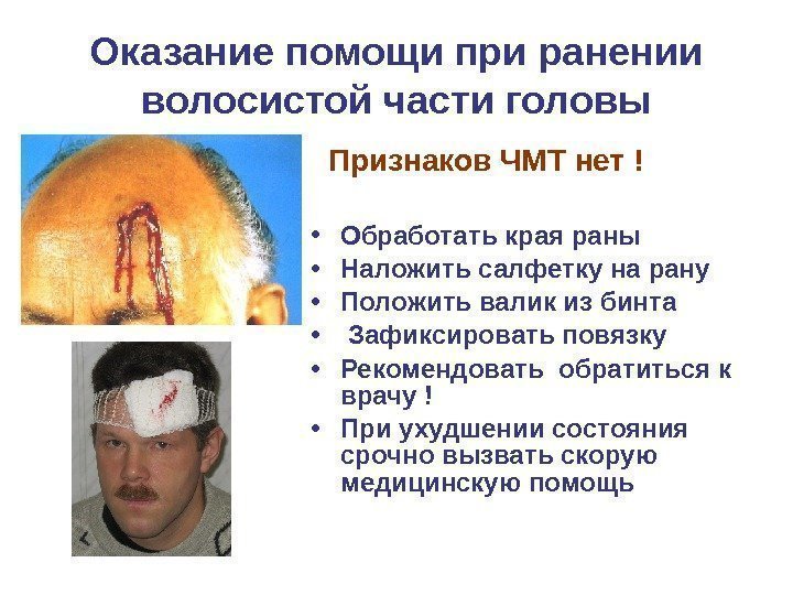   Оказание помощи при ранении волосистой части головы  Признаков ЧМТ нет !