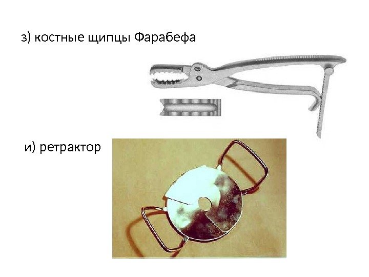 з) костные щипцы Фарабефа и) ретрактор 
