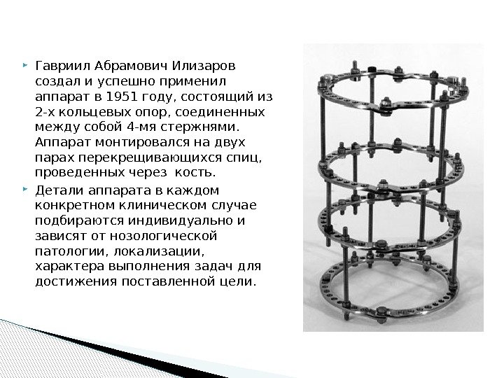 Аппарат илизарова презентация