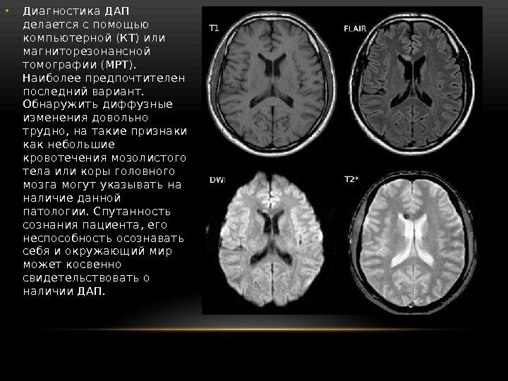 Дап кт картина