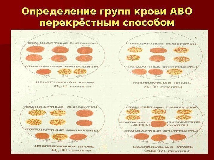 Определение групп крови АВО перекрёстным способом 