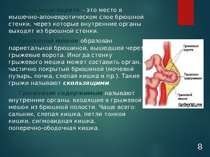 Грыжевые ворота  – это место в мышечно-апоневротическом слое брюшной стенки, через которые внутренние