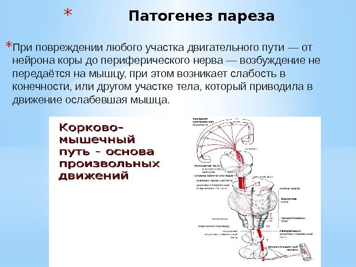 Путь основа. Патогенез периферического паралича схема. Патогенез пареза. Этиология парез. Схема патогенеза центрального паралича.