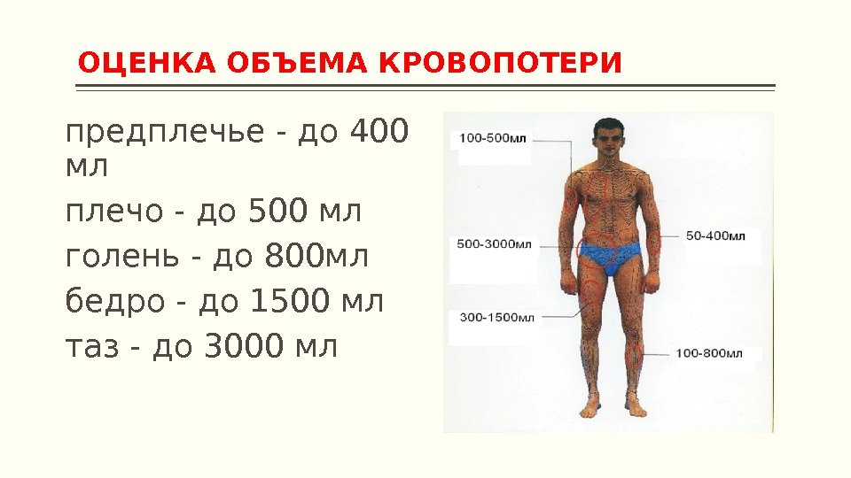 ОЦЕНКА ОБЪЕМА КРОВОПОТЕРИ предплечье - до 400 мл плечо - до 500 мл голень