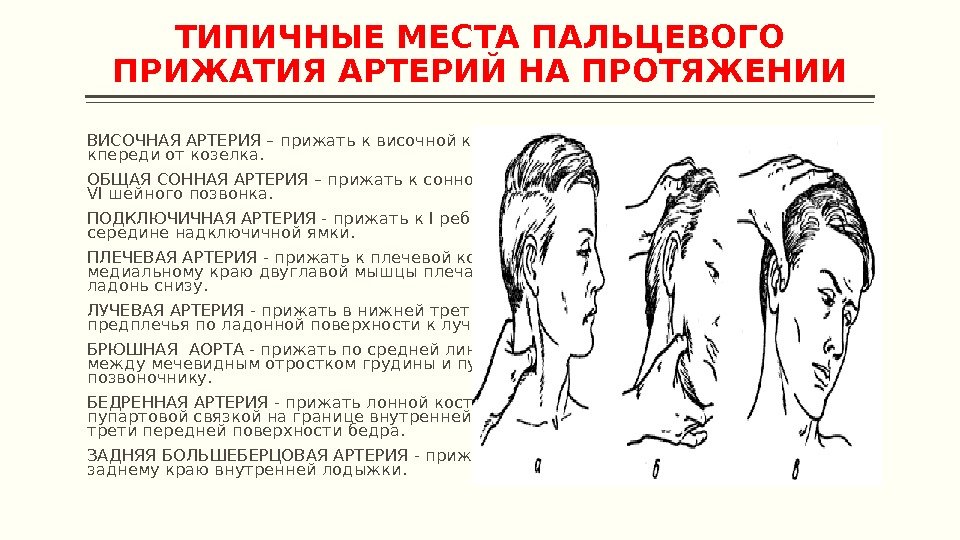 ТИПИЧНЫЕ МЕСТА ПАЛЬЦЕВОГО ПРИЖАТИЯ АРТЕРИЙ НА ПРОТЯЖЕНИИ ВИСОЧНАЯ АРТЕРИЯ – прижать к височной кости