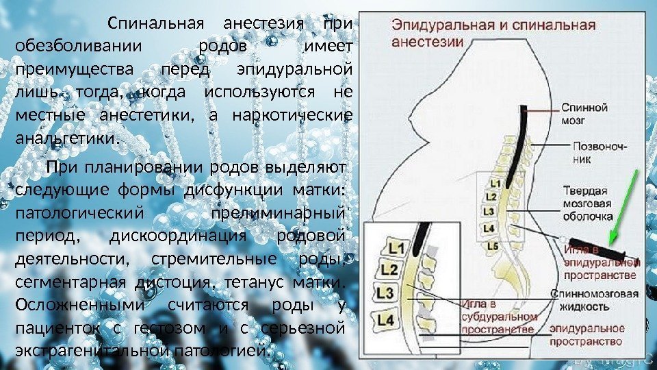 Лестница обезболивания воз схема