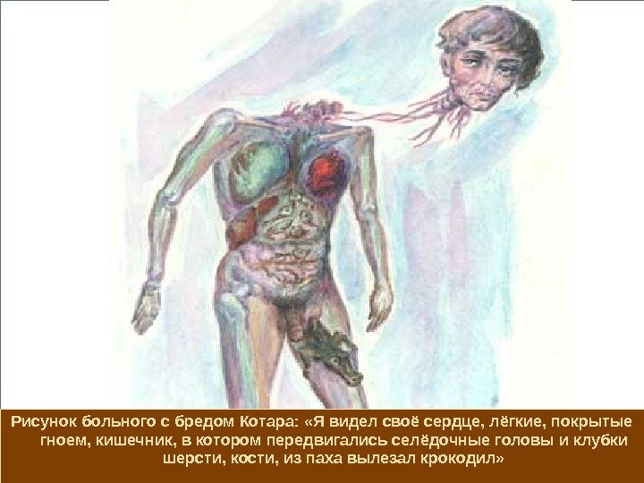 Рисунок больного с бредом Котара:  «Я видел своё сердце, лёгкие, покрытые гноем, кишечник,