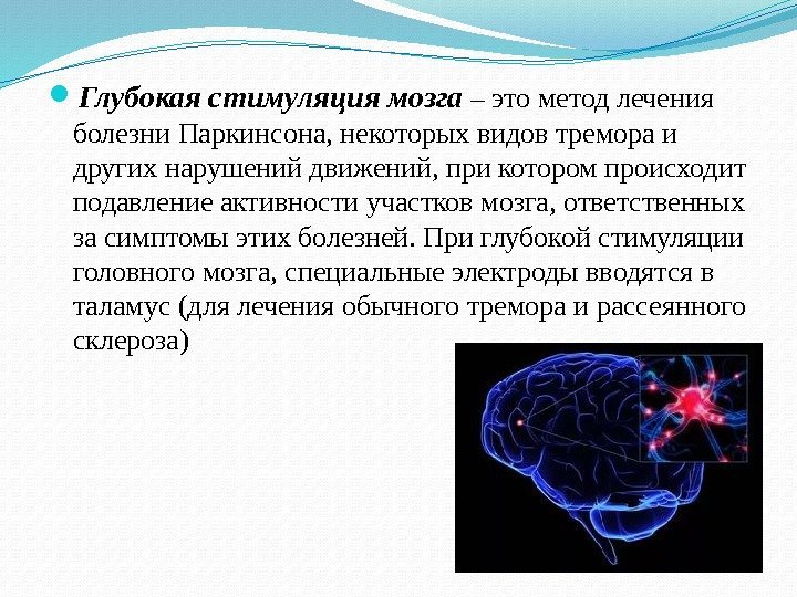  Глубокая стимуляция мозга – это метод лечения болезни Паркинсона, некоторых видов тремора и