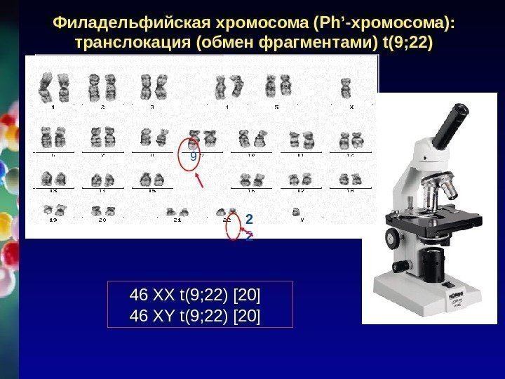 Филадельфийская хромосома ( Ph’- хромосома):  транслокация (обмен фрагментами) t(9; 22) 9 2 2