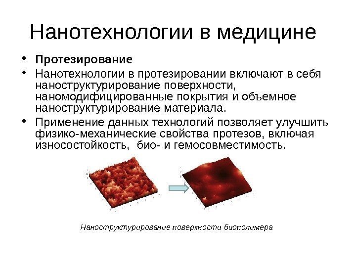 Нанотехнологии в медицине • Протезирование • Нанотехнологии в протезировании включают в себя наноструктурирование поверхности,