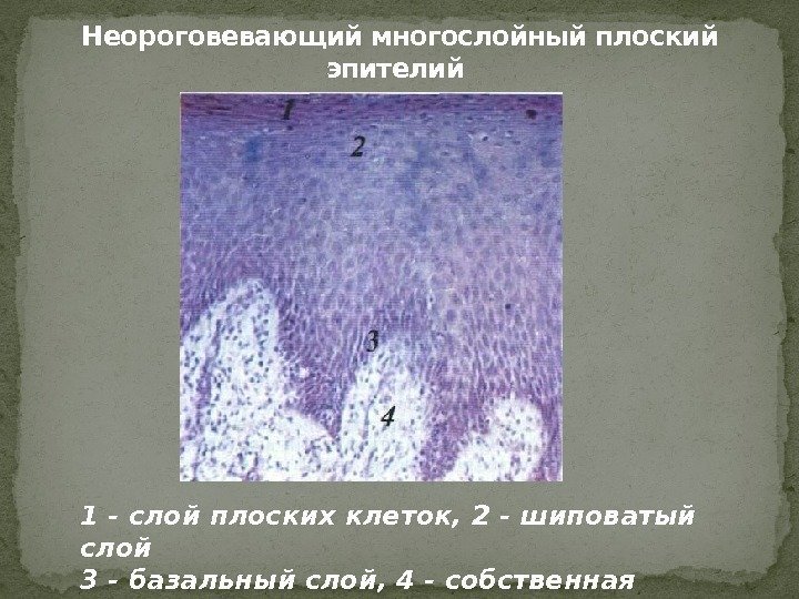 Неороговевающий многослойный плоский эпителий 1 - слой плоских клеток, 2 - шиповатый слой 3