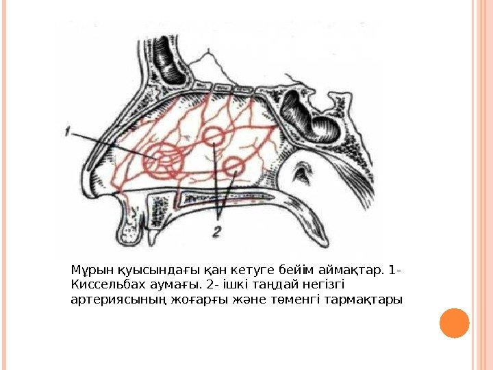 Мұрын қуысындағы қан кетуге бейім аймақтар. 1 - Киссельбах аумағы. 2 - ішкі таңдай