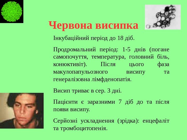   Червона висипка Інкубаційний період до 18 діб. Продромальний період:  1 -5