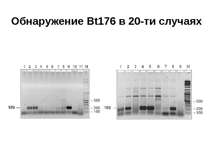 Обнаружение Bt 176 в 20 -ти случаях 