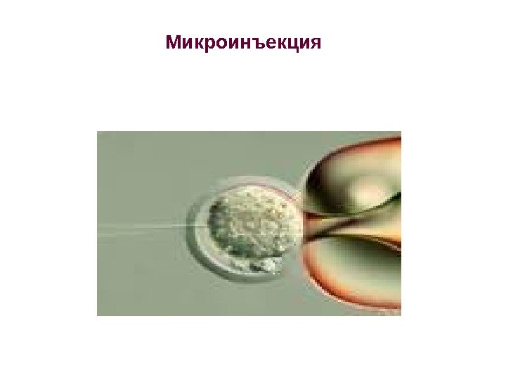 Микроинъекция 