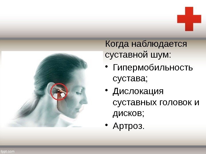 Когда наблюдается суставной шум:  • Гипермобильность сустава;  • Дислокация суставных головок и