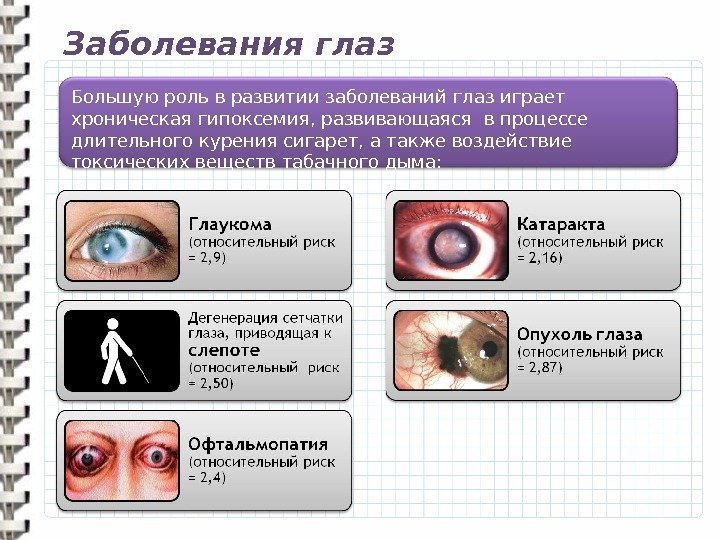 Заболевания глаз Большую роль в развитии заболеваний глаз играет хроническая гипоксемия, развивающаяся в процессе