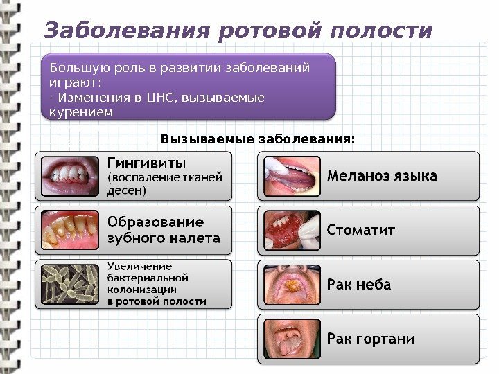 Заболевания ротовой полости Большую роль в развитии заболеваний играют: -  Изменения в ЦНС,