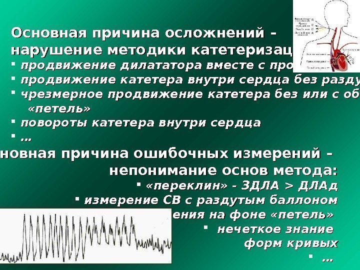 Основная причина осложнений – нарушение методики катетеризации: продвижение дилататора вместе с проводником продвижение катетера