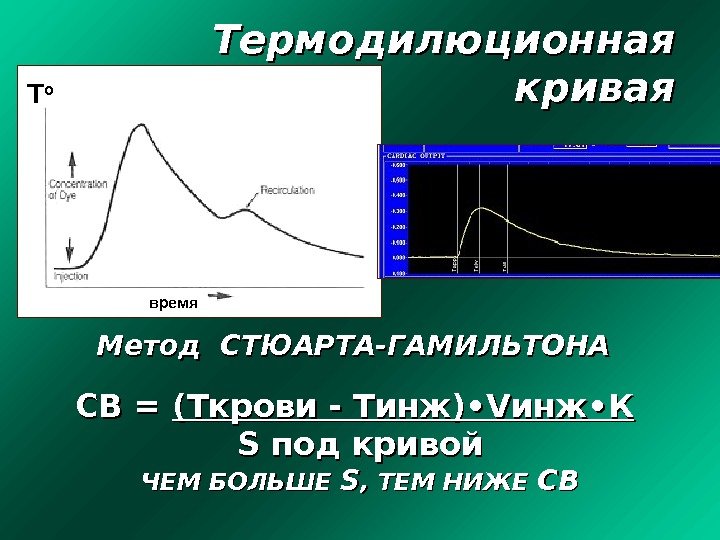 Термодилюционная кривая Метод СТЮАРТА-ГАМИЛЬТОНА СВ = (( TT крови - Тинж) • VV инж