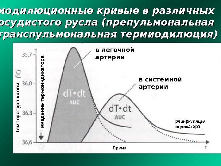  Термодилюционные кривые в различных участках сосудистого русла (препульмональная и транспульмональная термиодилюция) в легочной