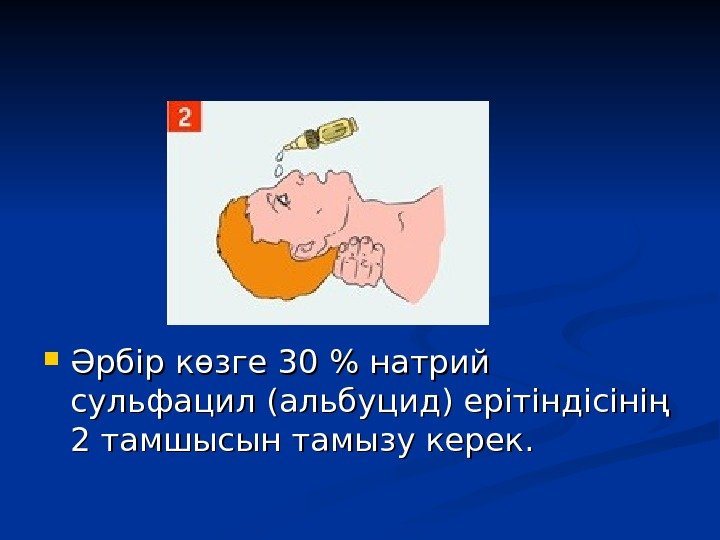  Әрбір көзге 30  натрий сульфацил (( альбуцид )) ерітіндісінің 2 тамшысын тамызу