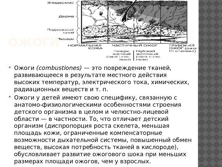 ОЖОГИ Ожоги (combustiones) — это повреждение тканей,  развивающееся в результате местного действия высоких