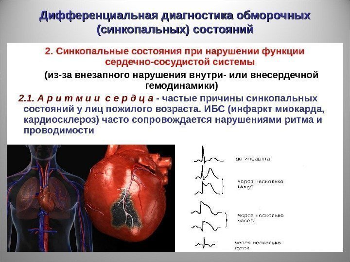 Дифференциальная диагностика обморочных (синкопальных) состояний 2. Синкопальные состояния при нарушении функции сердечно-сосудистой системы 