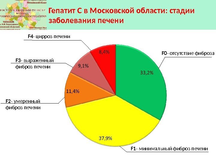 Гепатит С в Московской области: стадии заболевания печени F 0 - отсутствие фиброза F