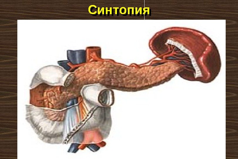 Синтопия 