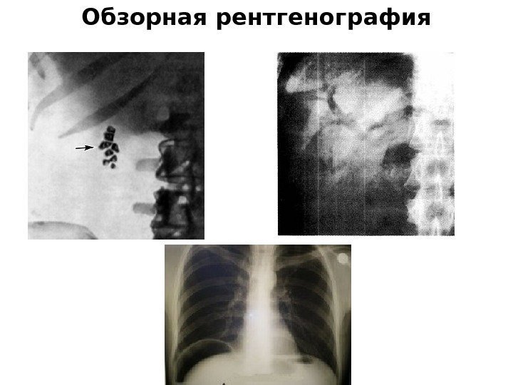 Обзорная рентгенография 