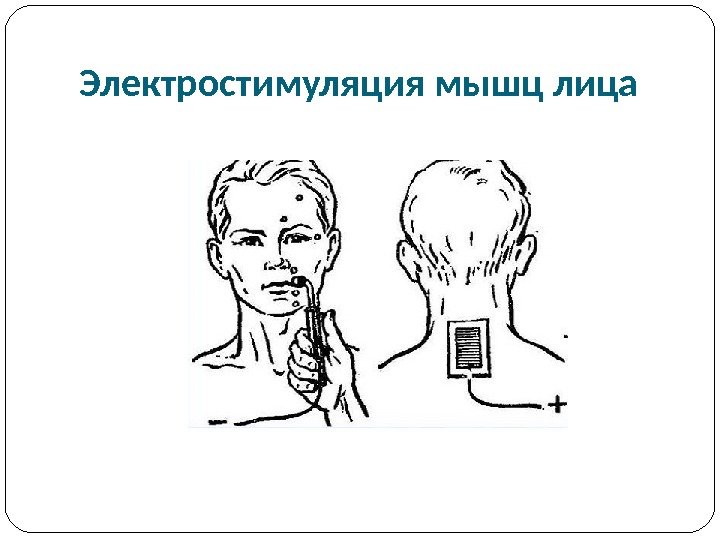 Электростимуляция мышц лица 