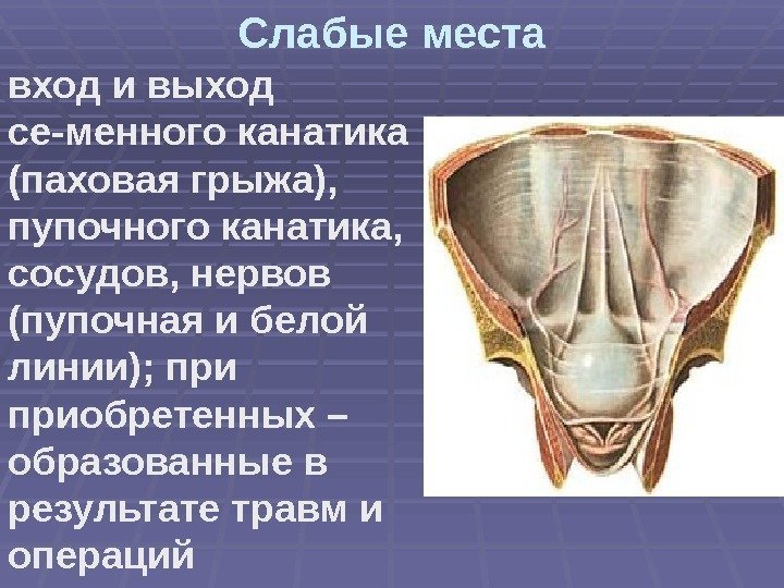 Слабые места вход и выход се-менного канатика (паховая грыжа),  пупочного канатика,  сосудов,