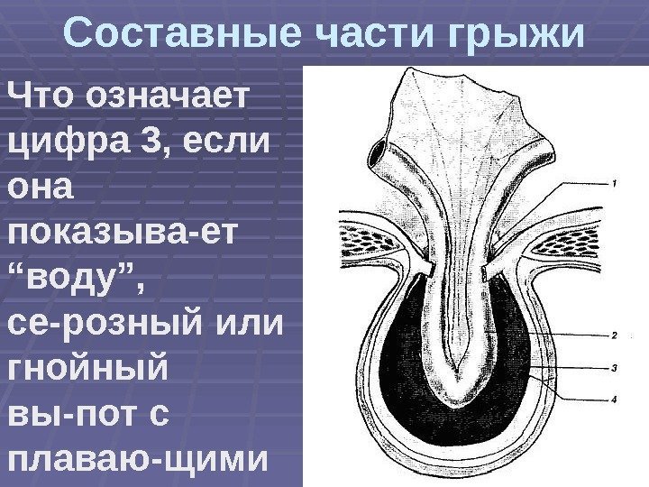 Составные части грыжи Что означает цифра 3, если она показыва-ет  “воду”,  се-розный