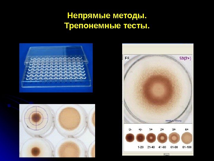 Непрямые методы. Трепонемные тесты. 